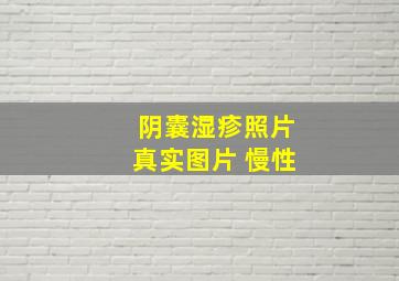 阴囊湿疹照片真实图片 慢性